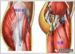 什么是滑囊炎常见部位？